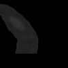 SPORK, NICO - 22.03.1976 - 02.08.2022 - CT obere Extremität - 18:01:46
